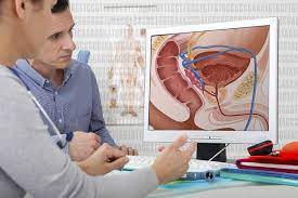 Prostate cancer