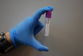 lab tube