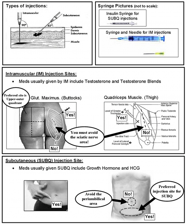 subq injections